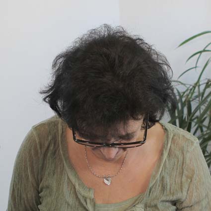 SensiHair Vergleich: Oberkopf Frau nachher